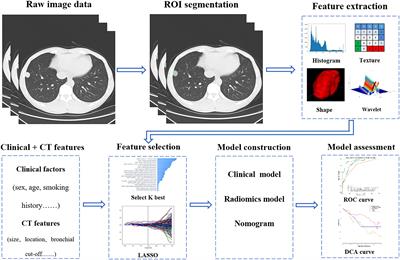 The diagnostic value of CT-based radiomics nomogram for solitary indeterminate smoothly marginated solid pulmonary nodules